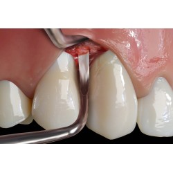 Hu-friedy Scaler Sichel EverEdge2.0 135 #9 1ks