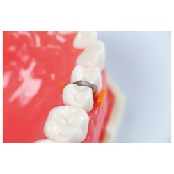 Directa FenderWedge Extra Small Fialové 36ks