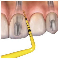 Hu-Friedy Colorvue® Plastic Probe Sonda Koncovky Žlutá  3-6-9-12 12ks