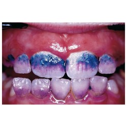 HAGER WERKEN MIRA-2-TON Detektor Plaku 60 ml