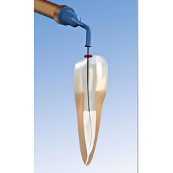 ULTRADENT NaviTip™ (25mm Ø0,33mm 30ga) Modrá  20ks