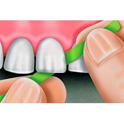 Polydentia Polishing Strip Brusná Páska 30 µm 10m Zelená 1ks