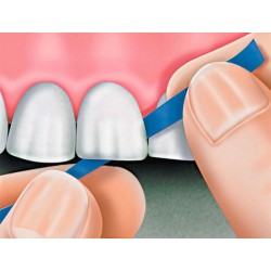 Polydentia Polishing Strip Brusná Páska 40µm 10m Modrá 1ks