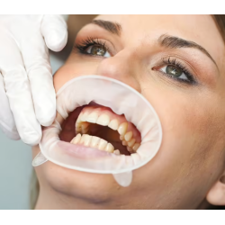 Ivoclar Vivadent Optragate 2 Sortiment 80ks