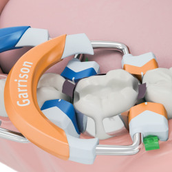 Garrison Composi-Tight®3D Fusion Molár Kroužek Oranžová 2ks