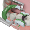 Garrison Composi-Tight® 3D Fusion Kroužek Zelená 2ks